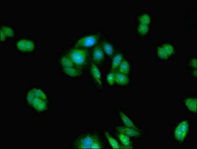 TMEM67 Antibody