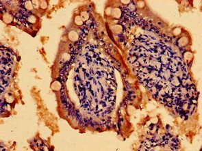 TMEM67 Antibody