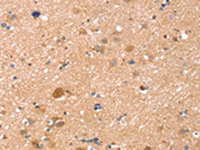 TMSB10 Antibody