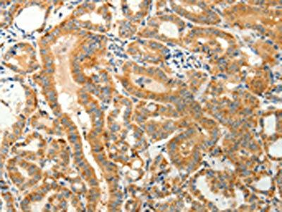 TMSB4X Antibody