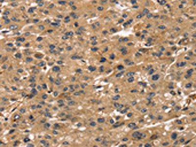 TMSB4X Antibody