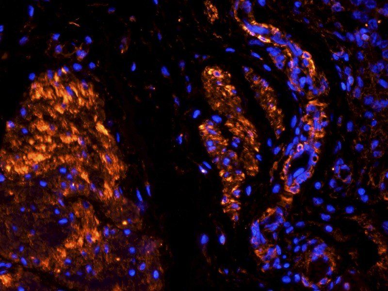 TNF alpha Rabbit Polyclonal Antibody