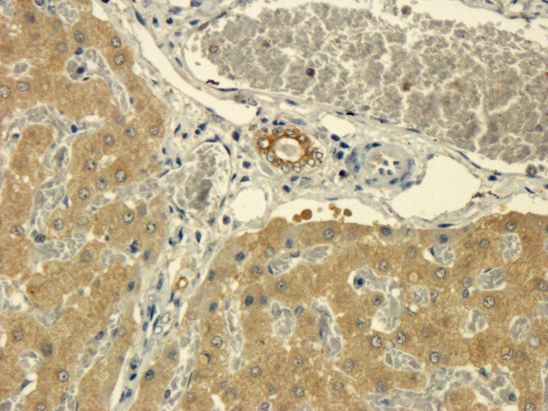 TNF alpha Rabbit Polyclonal Antibody