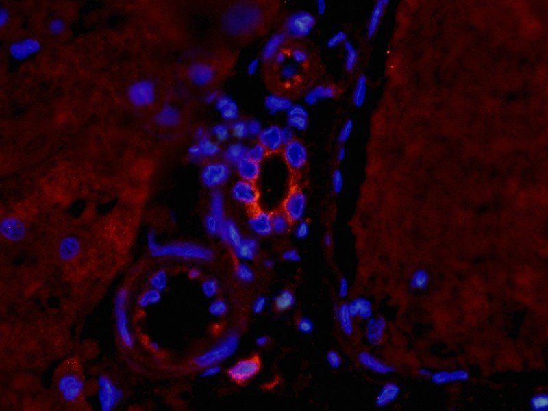 TNF alpha Rabbit Polyclonal Antibody