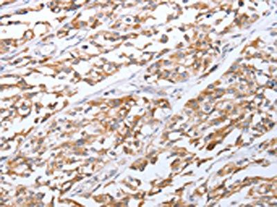 TNF Antibody