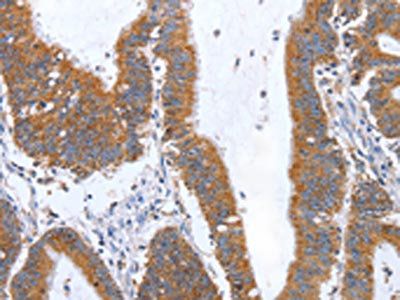 TNF Antibody