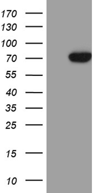 TNF alpha Antibody