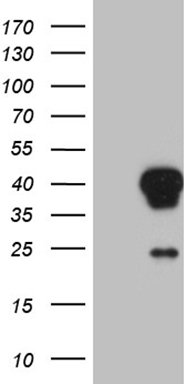 TNF alpha Antibody