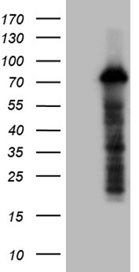 TNF alpha Antibody