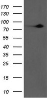 TNF alpha Antibody