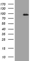 TNF Antibody