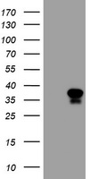 TNF Antibody