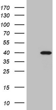 TNF alpha Antibody