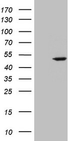 TNF alpha Antibody