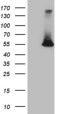 TNF Antibody