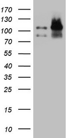 TNF alpha Antibody