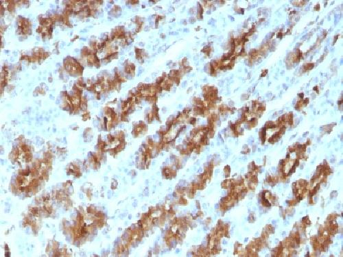 TNF Antibody