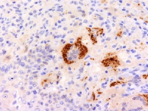 TNF Antibody