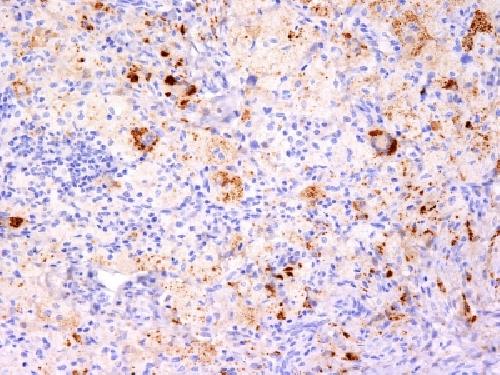 TNF Antibody