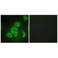 TNF Antibody