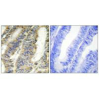 TNF Antibody