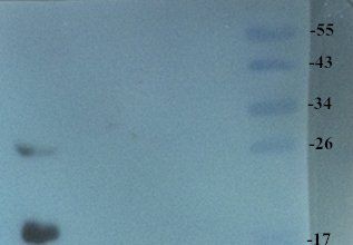 TNF alpha Rabbit Polyclonal Antibody