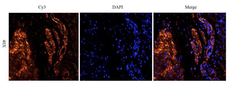 TNF alpha Rabbit Polyclonal Antibody