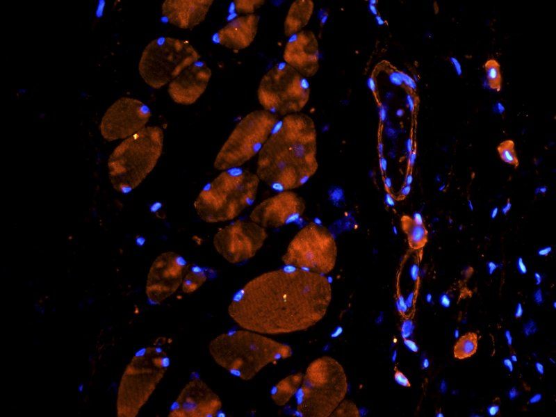 TNF alpha Rabbit Polyclonal Antibody