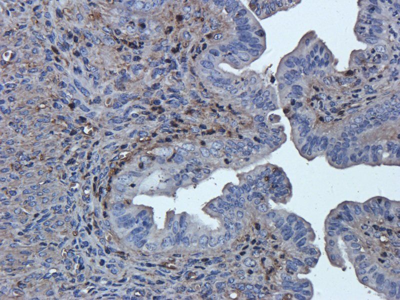 TNF alpha Rabbit Polyclonal Antibody