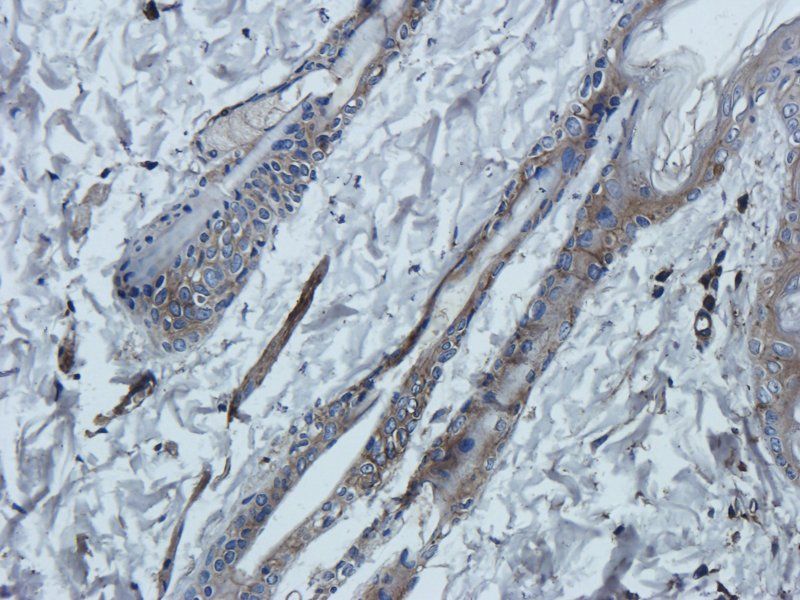TNF alpha Rabbit Polyclonal Antibody