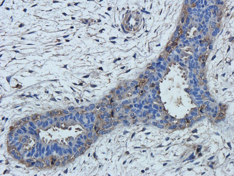 TNF alpha Rabbit Polyclonal Antibody