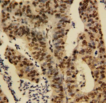 TNFAIP1 Rabbit Polyclonal Antibody
