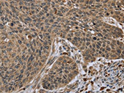 TNFRSF13C Antibody
