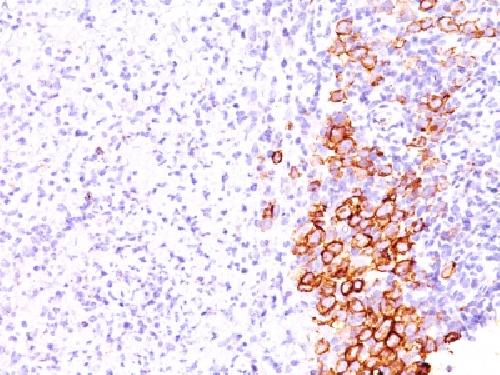 TNFRSF8 Antibody