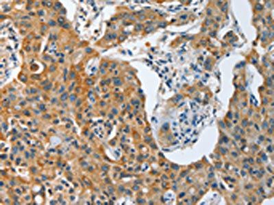 TNFSF13 Antibody
