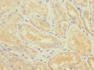 TNFSF15 Antibody