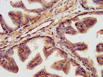 TNKS1BP1 Antibody