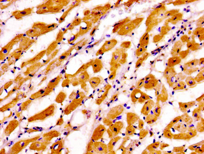 TNNI3 Antibody