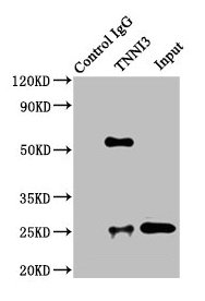 TNNI3 Antibody