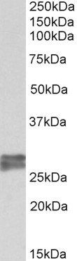 TNNI3 (aa117-127) Antibody