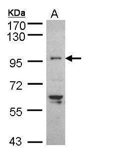 TNNI3K Rabbit Polyclonal Antibody