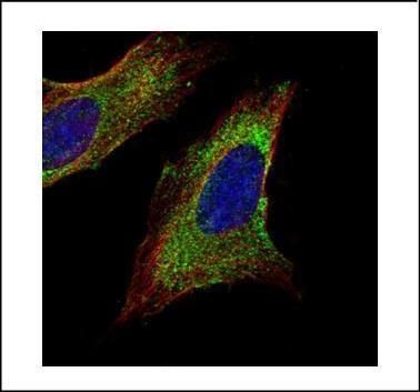 TOM1L1 Rabbit Polyclonal Antibody