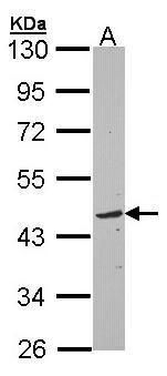 TOM1L1 Rabbit Polyclonal Antibody