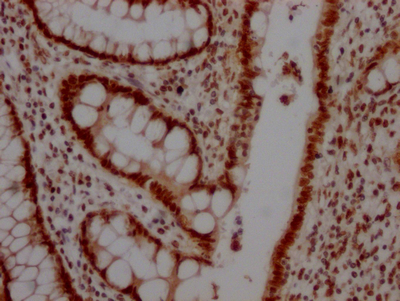 TOP1 Antibody