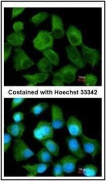 TPP1 Rabbit Polyclonal Antibody