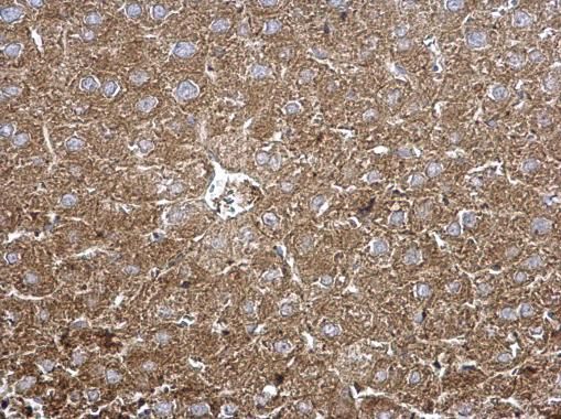 TPP1 Rabbit Polyclonal Antibody