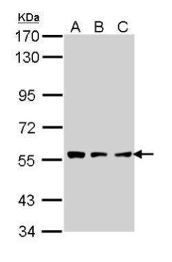 TPP1 Rabbit Polyclonal Antibody