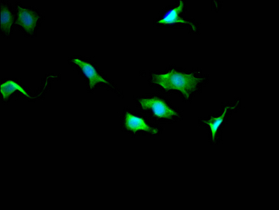 TPT1 Antibody