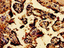 TPT1 Antibody