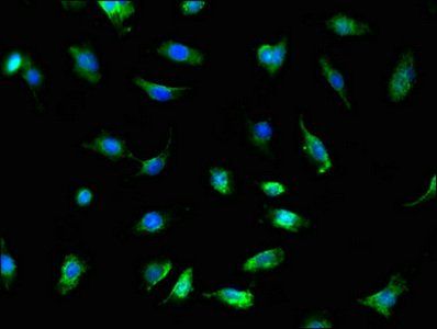 TRADD Antibody